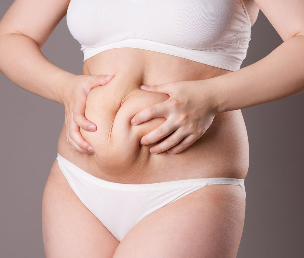 Abdominoplastia Barcelona - Cirugía del Abdomen
